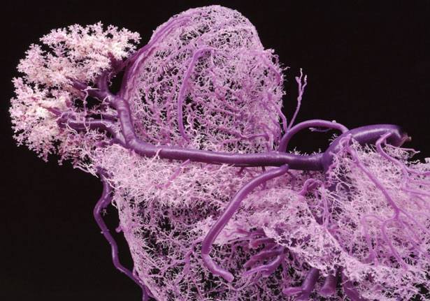 3d-printing-medical-blood-vessels