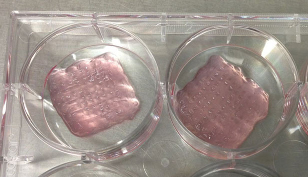 3d-printing-medical-cartilage-scaffolds