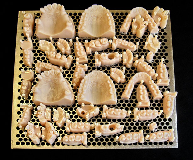 3d-printing-medical-dentistry