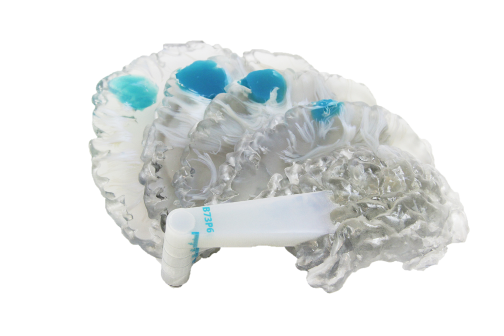 A segmented brain model showing the structure of a patient's combined MRI & CT scan. Photo via: Whiteclouds 3DYourSCAN