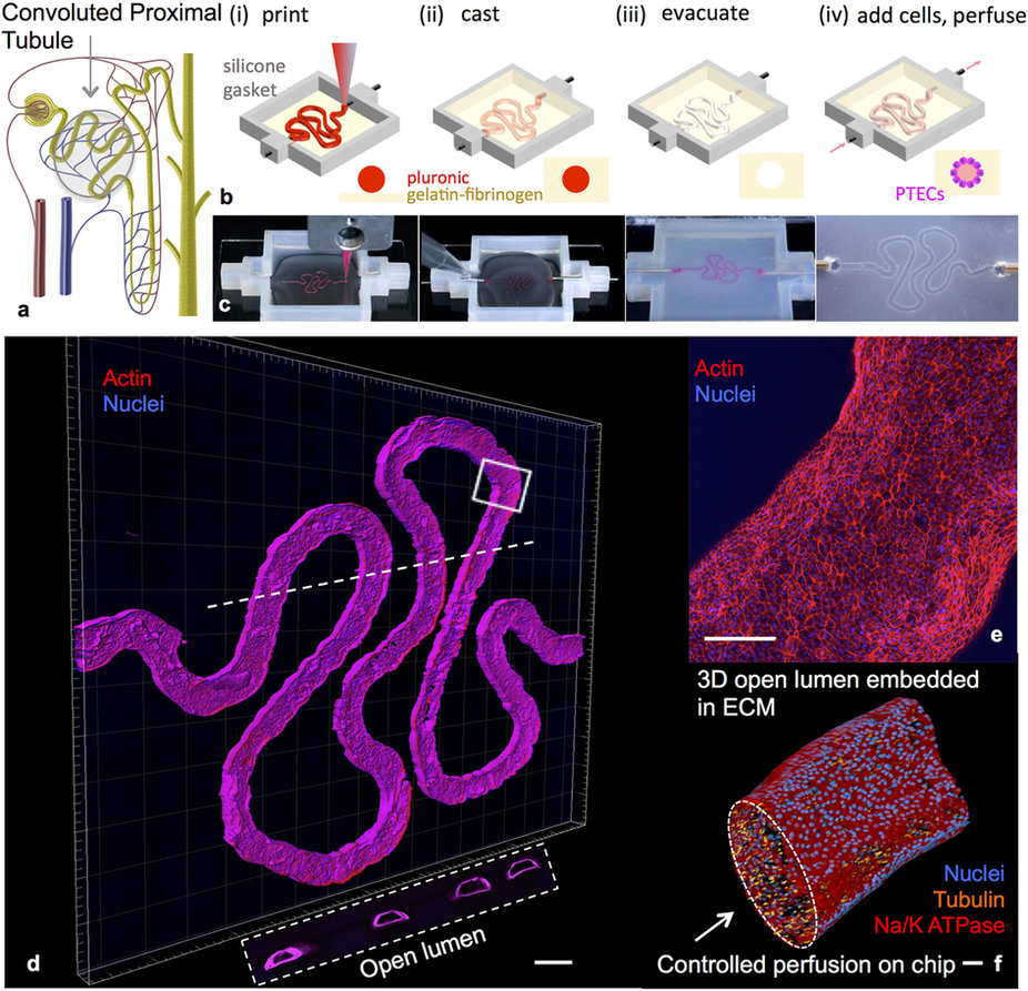3D convoluted renal proximal tubule on chip. Image via Nature's Scientific Reports journal