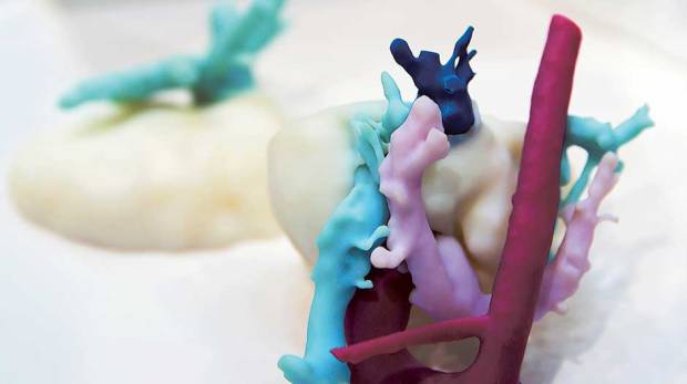 3D printed organ models. Image via DHA