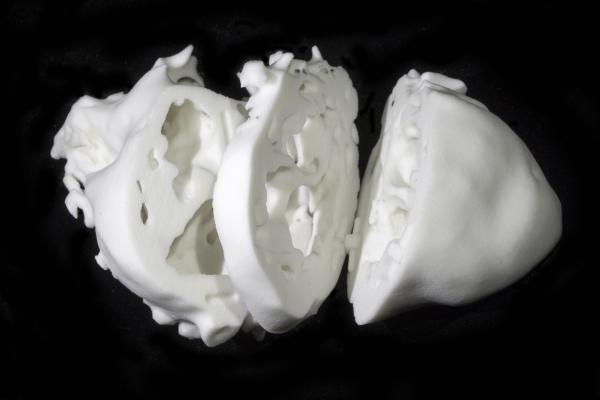 3d printing cardiology