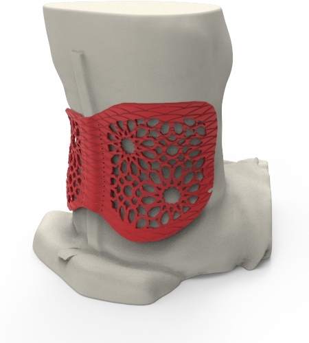 bussiness-wire-baltic3d-stratasys-back-support-paralympics
