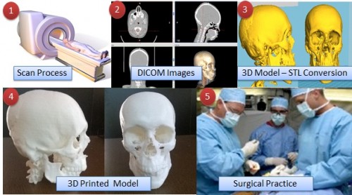 The process of creating 3D printed surgical models. Image via Think3D.
