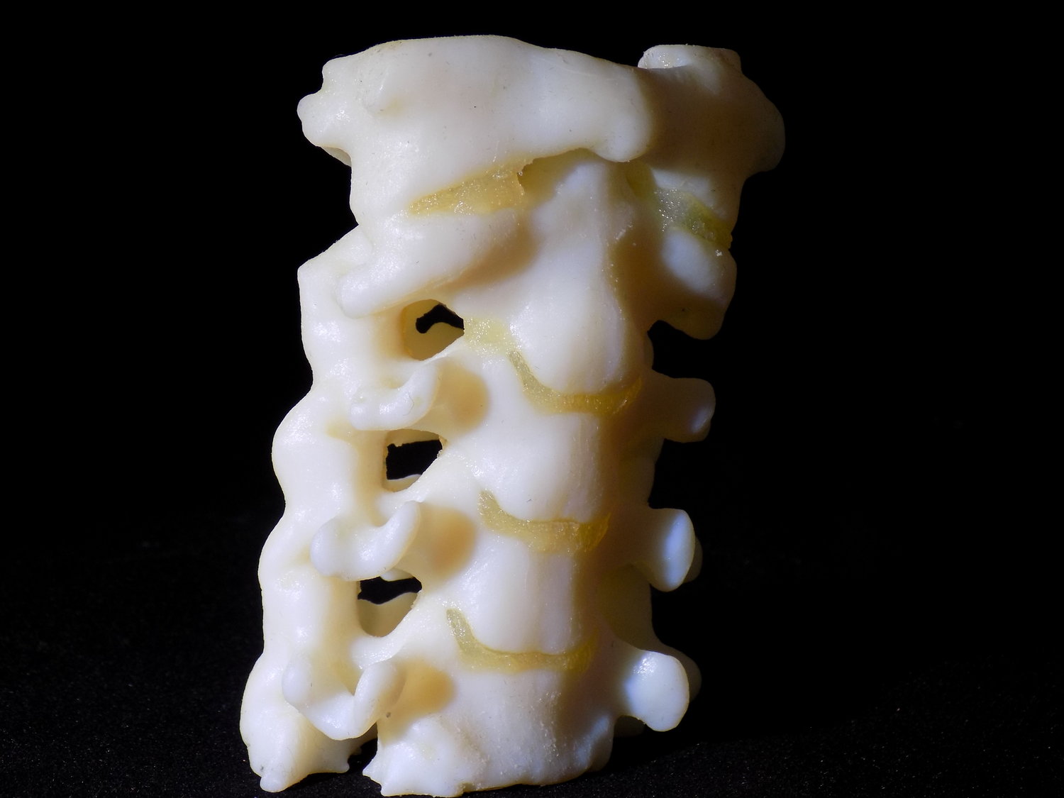 Cervical spine with cartilage. Photo via SiMMO3D.