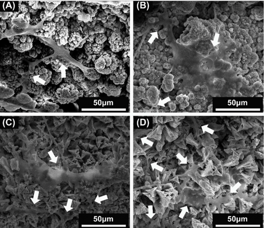 Images taken through a microscope show the attachment of human bone marrow cells in 4 different samples of C3S/MBG. Image via: