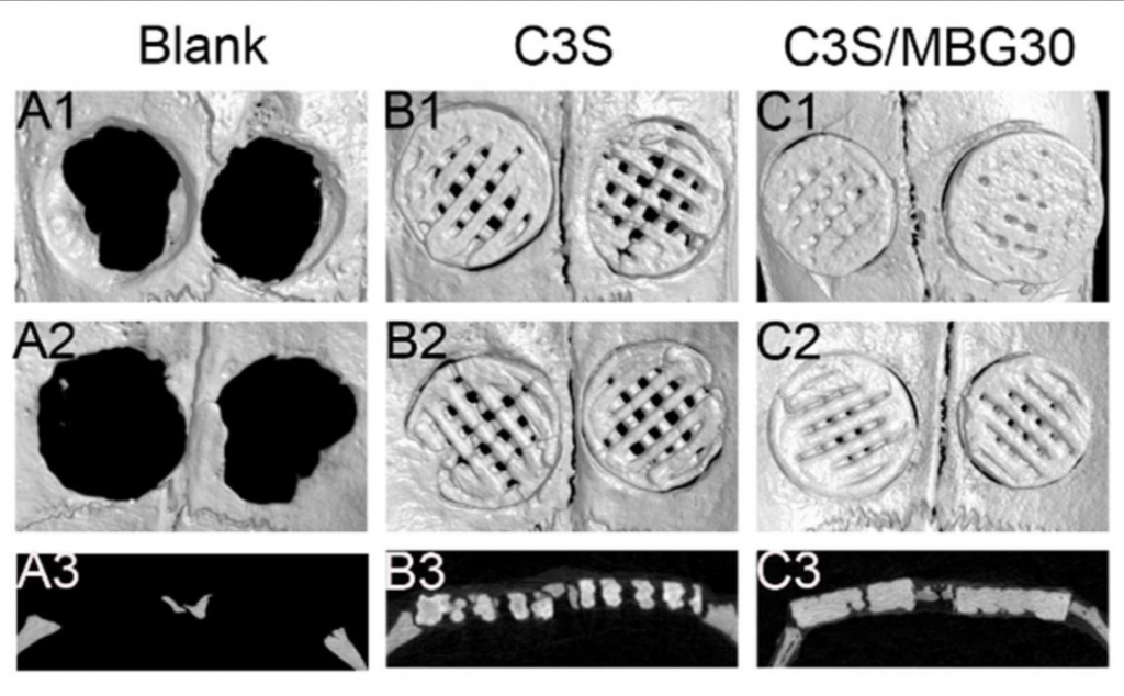 The above image from Shanghai researchers shows how scaffolds formed within cavities of a model rat skull. Image via: Journal of Materials Chemistry B