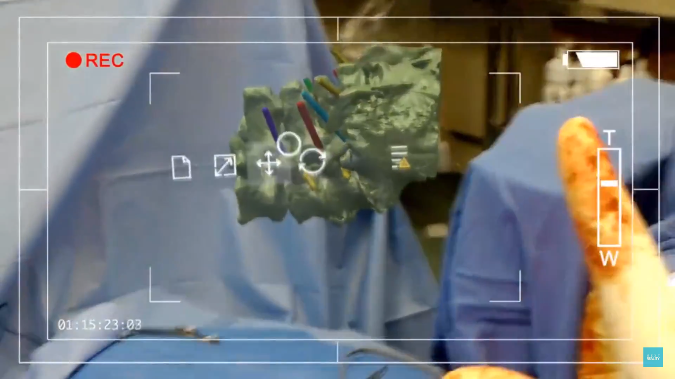 Screenshot of Hololens being used in surgery. Image via NextReality. 