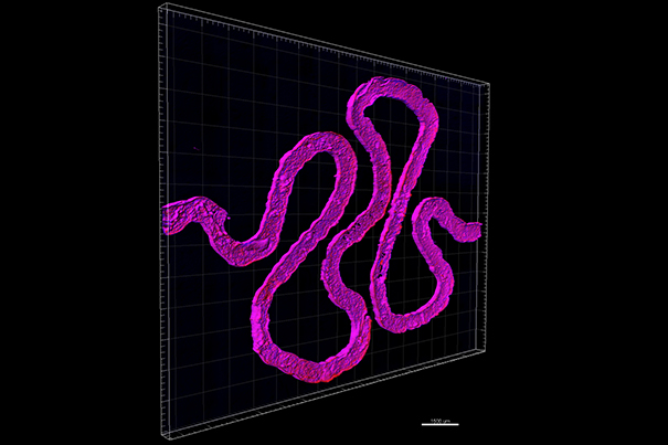 The structure of proximal tubules found inside a human kidney Image via: Wyss Institute at Harvard University