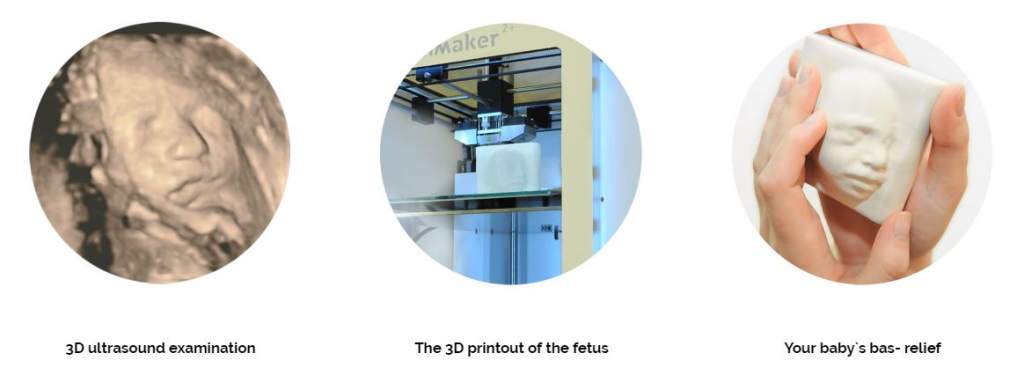 The steps of creation. Image: In Utero 3D